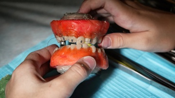 Большая медицинская программа: стоматология