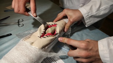 Большая медицинская программа: травматология